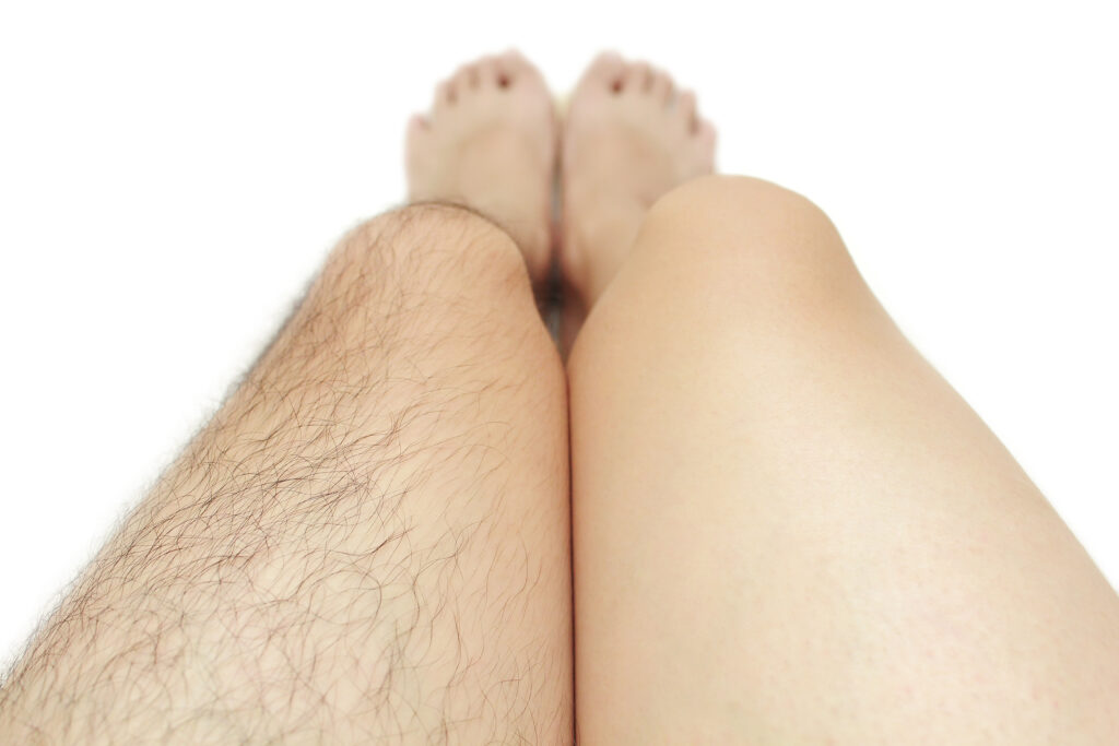 足の脱毛前と脱毛後の違いを表した写真
