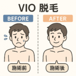 脱毛前と脱毛後の男性の表情を表したイラスト